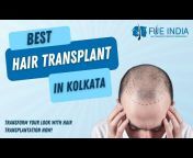 Fue India Hair Transplant
