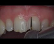 Dental tips u0026 tricks