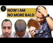 New Roots Hair Transplant Kolkata