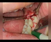 Dt DentalTerapi Ağız ve Diş Sağlığı Polikliniği