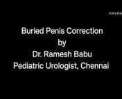 Dr. Ramesh Babu