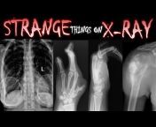 X-Ray Review - Educational Radiology Channel