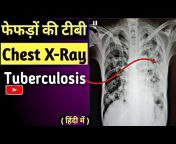 Uday X Ray