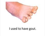 Gout VSL from gout