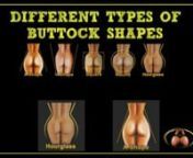 When it comes to buttock augmentation, one of the important things to get a good result is to determine prior to surgery what type of buttock shape you have. There are four different buttock shapes: A-shaped, V-shaped, square, and round. This is important because buttock augmentation is a major sculpting procedure. There are areas of deficiency and areas that will require augmentation. Some areas will require removal by liposuction. Ultimately, the main goal is to recreate an overall hourglass s