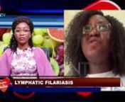vJoin Damilola Ajao on Health is Wealth as she engages Blessing Ankrah (Coordinator Netrodis Research Group NENR, Ghana), on the discuss Lymphatic Filariasis - Complications to Human Health and Preventive Measures, nShowing on KAFTAN TV Startimes Channel 480 DTH, 124 DTT nationwide.nnVisit &#124; www.kaftan.tvn#imagineabeautifulworld #KAFTANTV #healthiswealth #lymphaticfilariasis #preventivemeasures #share #like #commentnhttps://vimeo.com/714541586