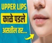 Upper lips खूप काळे पडलेत का? &#124; How to Lighten Dark Upper Lip &#124; Dark Upper Lips Treatment &#124; #lokmatsakhi #DarkUpperLips #darklips #howtolightendarklips #howtogetpinklips Upper lips खूप काळे पडले का? नेमका हा काळेपणा घालवायचा कसा? जाणून घेण्यासाठी हा विडिओ शेवट्पर्यंत नक्की बघा... Disclaimer: The information provided on this channel and its video is for educational purpose only and should not consider as professional advice. We are trying to provide a perfect, valid, specific, detailed information. We are not a licensed professional so make sure with your professional consultant in case you need. All the content published in our channel is our own creativity&#60;br/&#62;