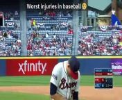 Baseball has witnessed some devastating injuries over the years, including career-threatening fractures, torn ligaments, and concussions. These incidents often result from collisions, high-impact plays, or pitchers experiencing arm injuries. These injuries not only affect the players physically but also have a significant emotional impact on fans and the baseball community.