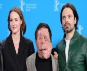 Sebastian Stan is calling out a journalist who described his latest film character, who has a facial disfigurement, as a &#92;