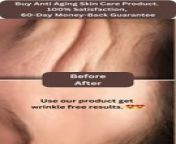 Note:100% Satisfaction, 60-Day Money-Back Guarantee. Witness the astonishing transformation from wrinkled to radiant!See the remarkable before and after of a journey towards smoother, youthful skin. Let these results inspire your skincare routine! For more queries, visit the page mentioned in the profile bio section. &#60;br/&#62;https://sites.google.com/view/best-skincare-for-aging-skin/home