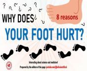 Foot pain is a fairly common syndrome that can make everyday tasks difficult.&#60;br/&#62;The following disorders may be behind foot pain: plantar wart; callus; hallux valgus deformity of the first toe; rheumatoid arthritis; plantar fasciitis; gout; Morton&#39;s neuroma; injury or bone fracture.&#60;br/&#62;A plantar wart is characterized by pain when pressing on the foot, a flat and hard knot of hardened skin on the foot, and small black dots on the surface of the foot.&#60;br/&#62;Typically, plantar warts do not require treatment.&#60;br/&#62;Plantar warts are caused by papillomavirus.&#60;br/&#62;Signs of hallux valgus include pain in the base of the big toe, swelling, redness, tenderness and limited movement of the joint, and a bone spur on the side of the foot.&#60;br/&#62;If you have hallux valgus, wear soft shoes.&#60;br/&#62;The main causes of this disorder are: genetic predisposition and uncomfortable and narrow shoes.&#60;br/&#62;Symptoms of plantar fasciitis include heel stiffness and numbness, pain in the heel or under the arch of the foot.&#60;br/&#62;For plantar fasciitis, special inserts can be used.&#60;br/&#62;Morton&#39;s neuroma is a benign tumor of nerve tissue between the third and fourth toes. To relieve pain, you can remove your shoes or massage the sore area. Corticosteroids or surgery may be needed.&#60;br/&#62;Morton&#39;s neuroma occurs due to inflammation of the nerve. Tight shoes and high heels should be avoided.&#60;br/&#62;With callus, there is acute pain when pressing on the leg or heel.&#60;br/&#62;If you have a callus, avoid tight shoes, use a special insole, and take an analgesic.&#60;br/&#62;Acupuncture and physical therapy can relieve callus discomfort.&#60;br/&#62;Rheumatoid arthritis is characterized by heating and stiffness of the leg joints, redness, swelling, and pain in the leg joints.&#60;br/&#62;For rheumatoid arthritis, you need a balance between physical activity and rest, and take an analgesic.&#60;br/&#62;Acupuncture helps relieve pain due to arthrosis.&#60;br/&#62;Symptoms of gout include redness, swelling, intense pain in the thumb, chills and fever.&#60;br/&#62;For gout, non-steroidal anti-inflammatory drugs and colchicine are used.&#60;br/&#62;Signs of a bone fracture or injury include: pain in the leg after injury or sudden movement, swelling and inability to bear weight on the leg.&#60;br/&#62;If you cannot move your leg, are unable to move, or are unsure of the severity of the injury, it is recommended that you seek emergency medical attention.&#60;br/&#62;To treat a fracture, you may need hard bandages, plaster immobilization, surgery, and anti-inflammatory creams.&#60;br/&#62;Attention! This material is for informational purposes only. Before using any methods or treatments, it is recommended to consult a doctor!&#60;br/&#62;&#60;br/&#62;This material was prepared based on material from the channel https://youtube.com/@allscientifical&#60;br/&#62;&#60;br/&#62;This presentation uses graphic elements from the site https://www.canva.com