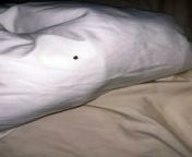 Mum horrified after finding bed bugs in Blackpool guest house from mum 054